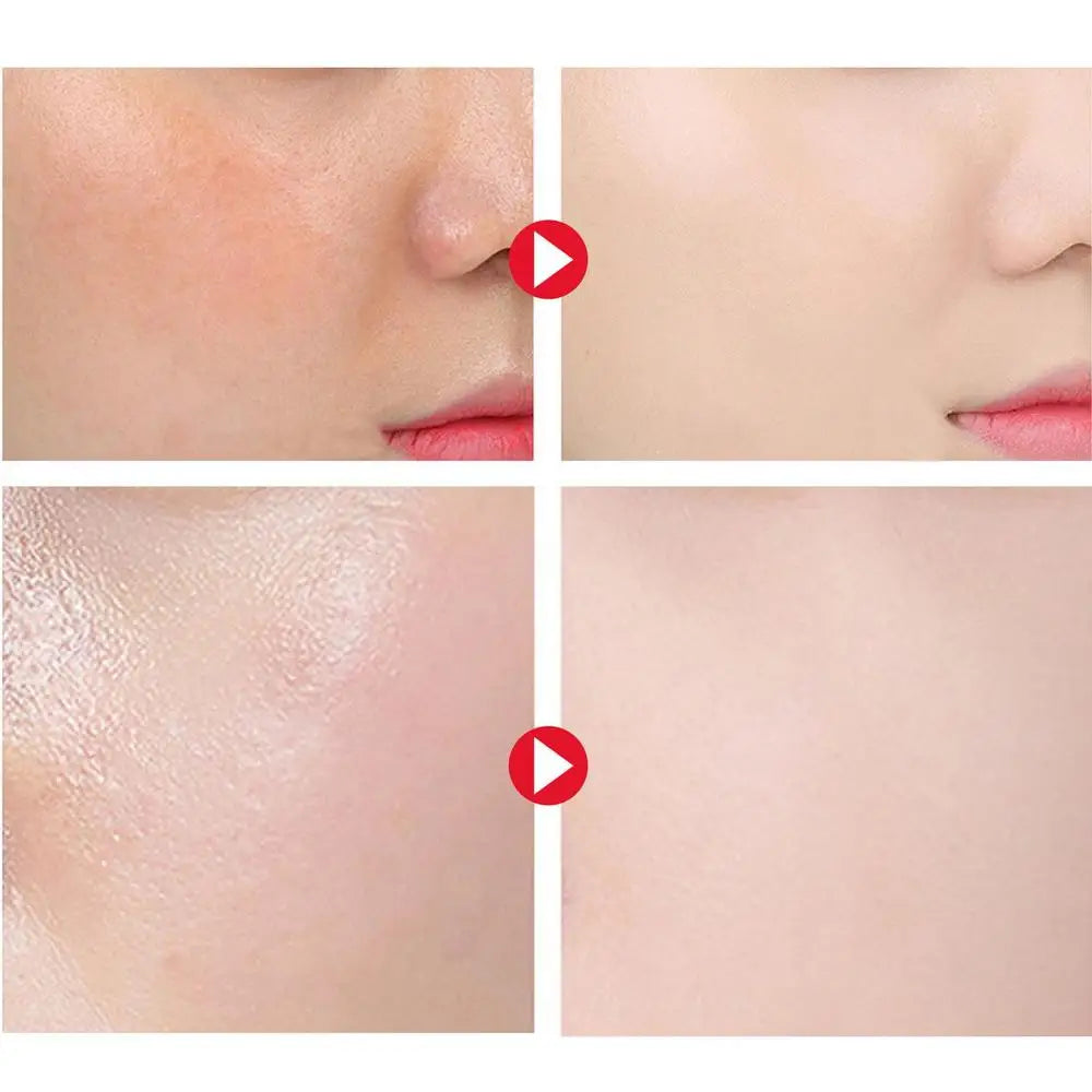 Facial Oil Control Mist Spray "100ml"